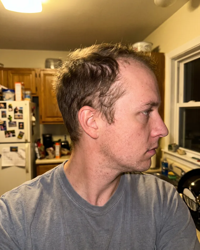 Jason M., before