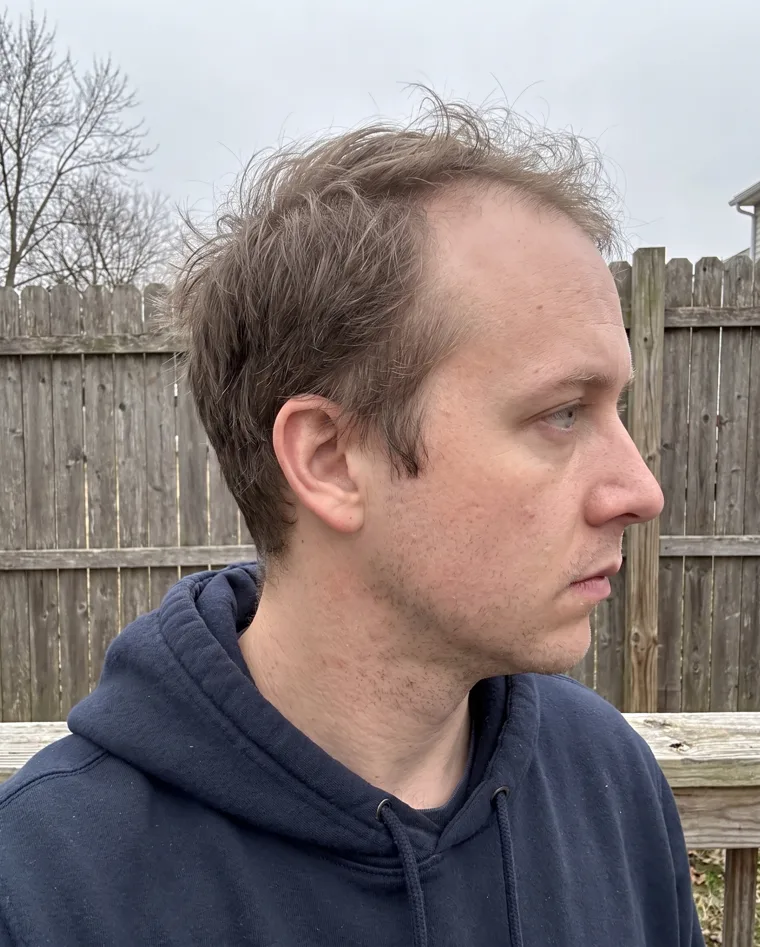 Jason M., month 7