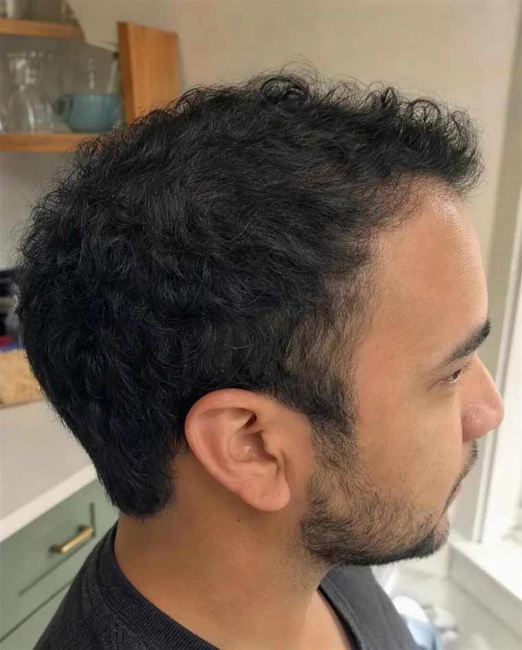Chris M., month 9