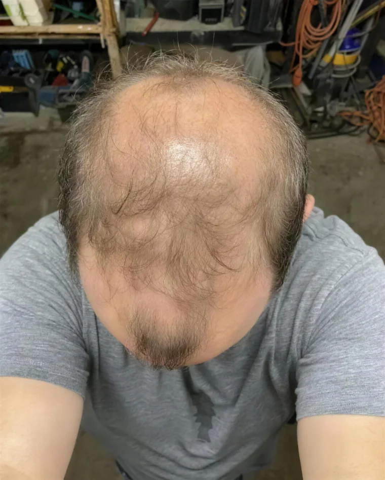 Ryan T., before