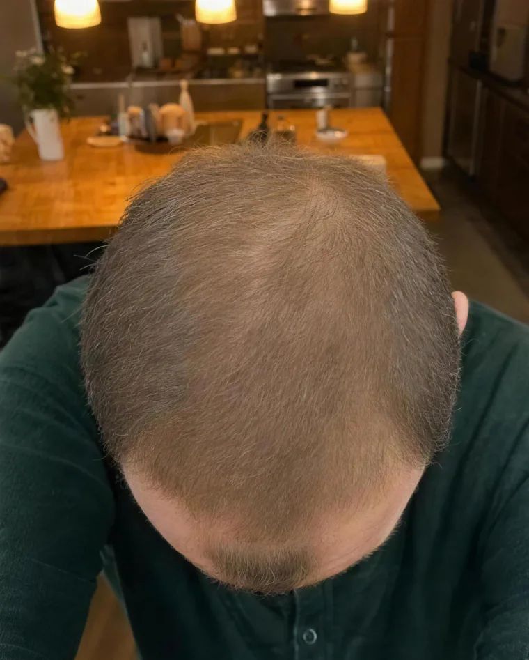 Ryan T., month 9