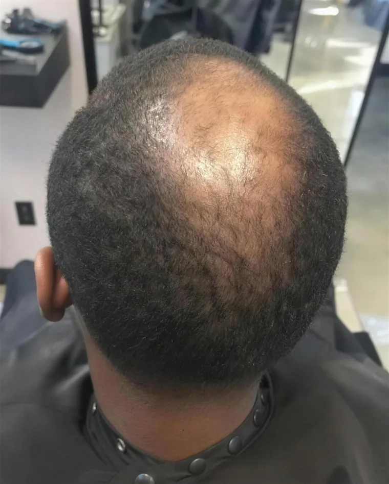 Andre W., before
