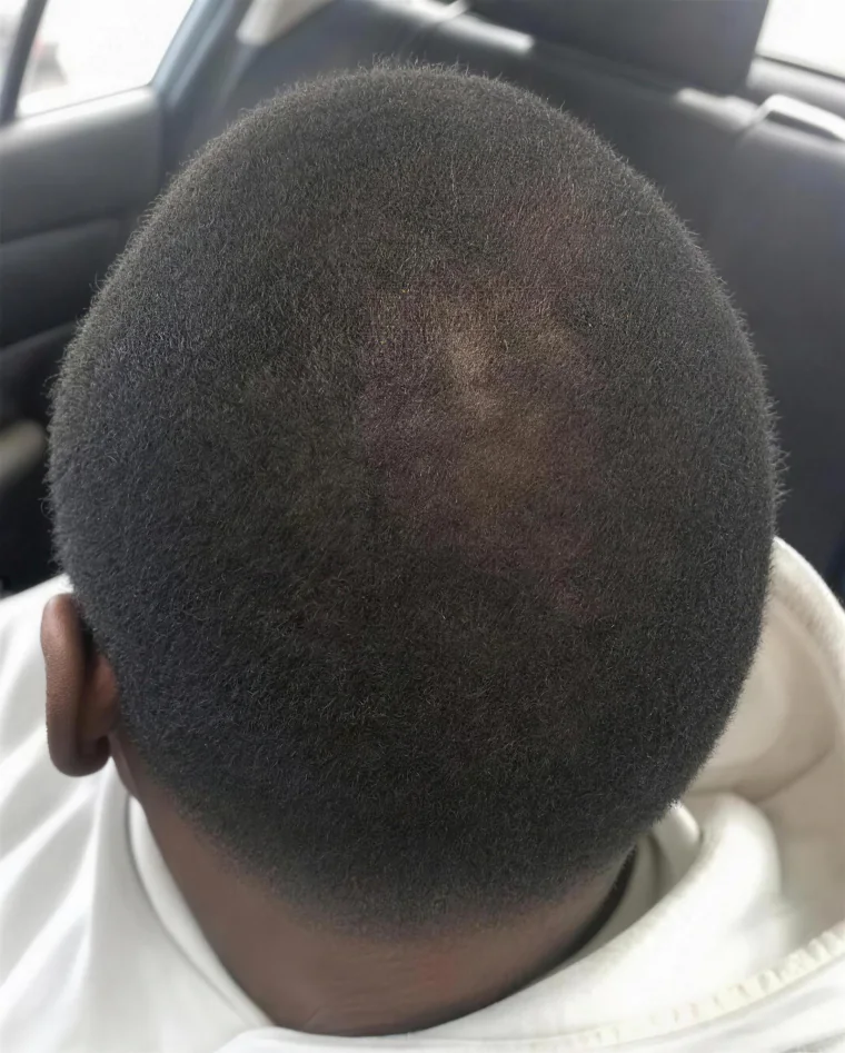 Andre W., month 7