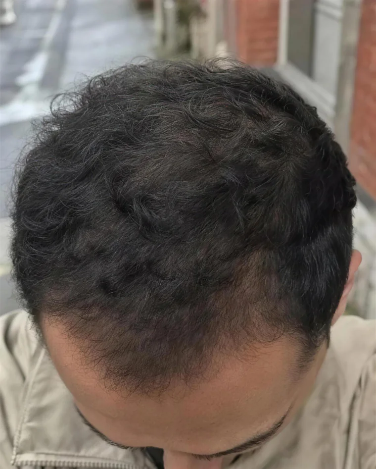 Marco L., month 8
