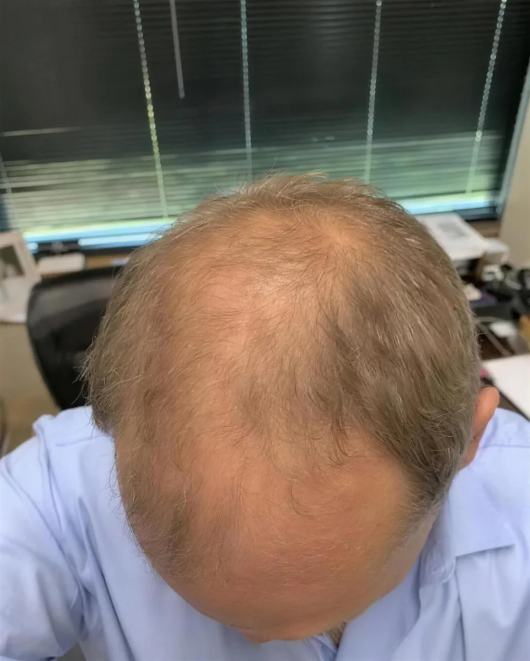 Greg N., before