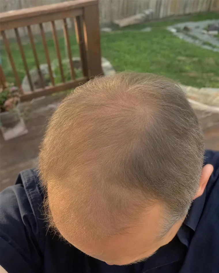 Greg N., month 6