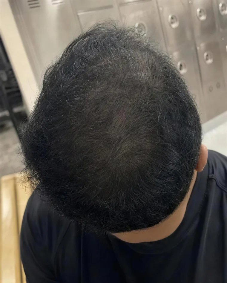 Raj P., month 8