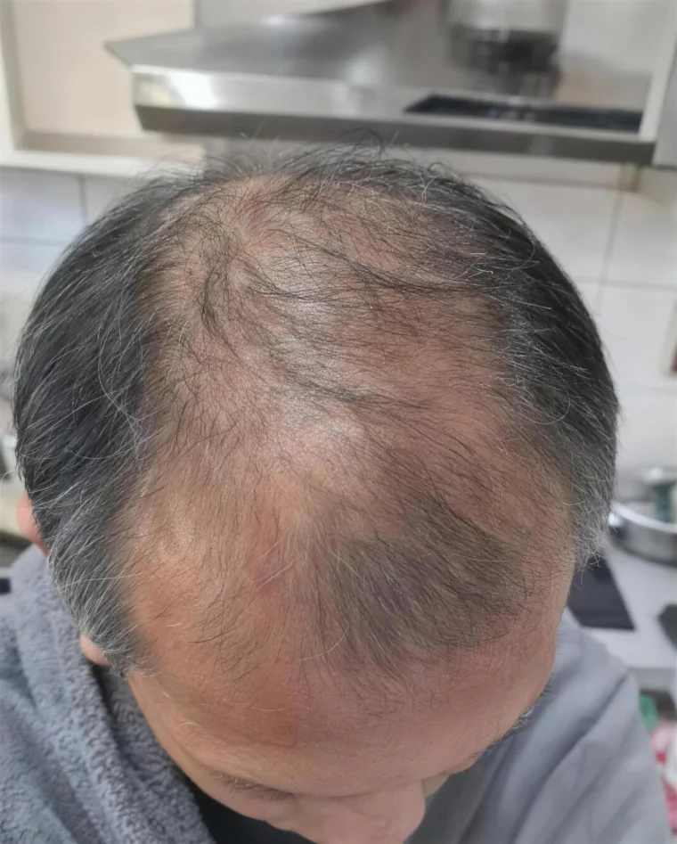 Ken H., before