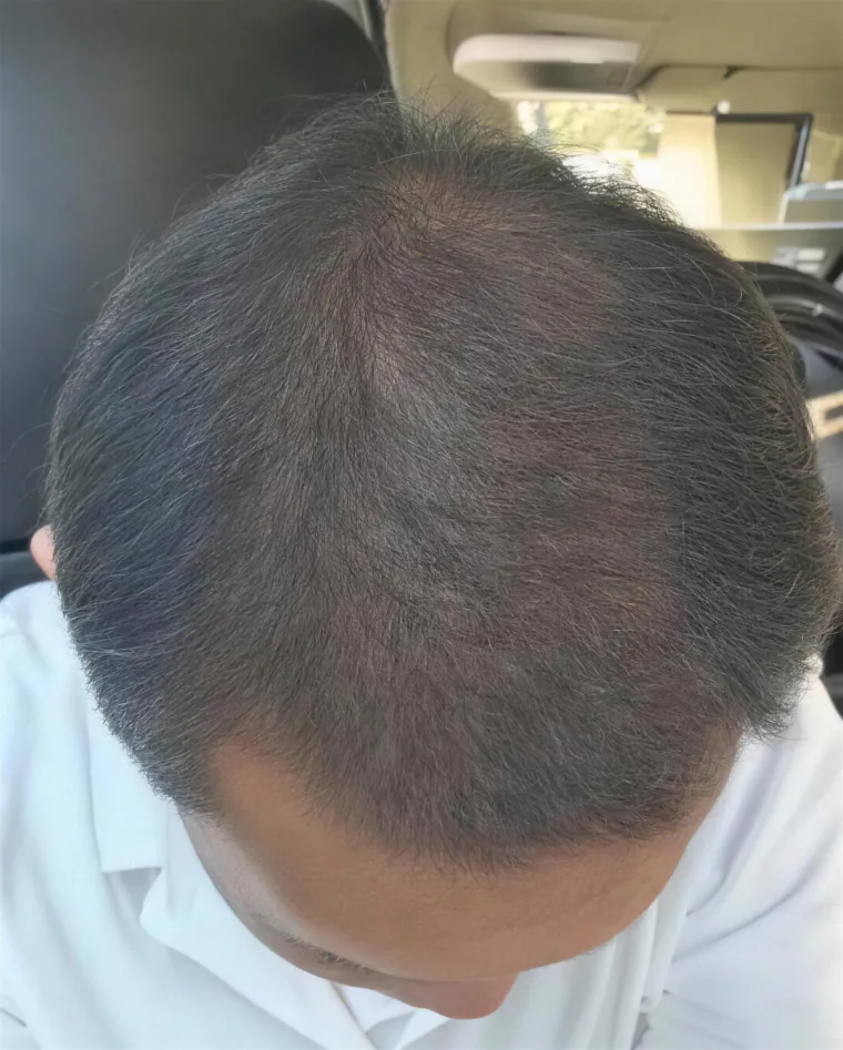 Ken H., month 7