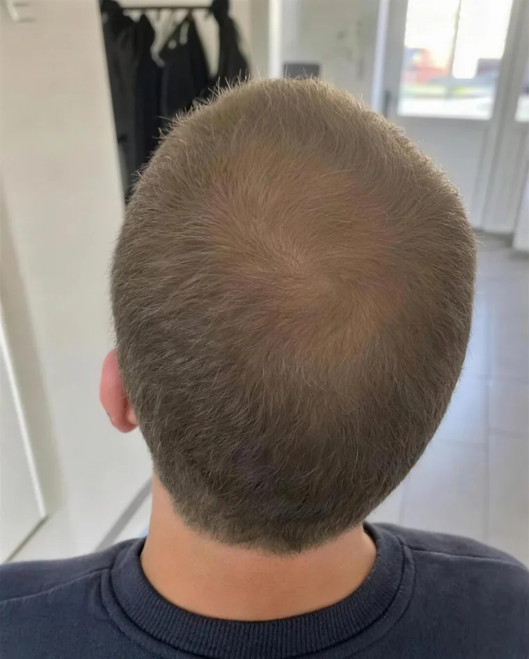 Tyler K., month 6
