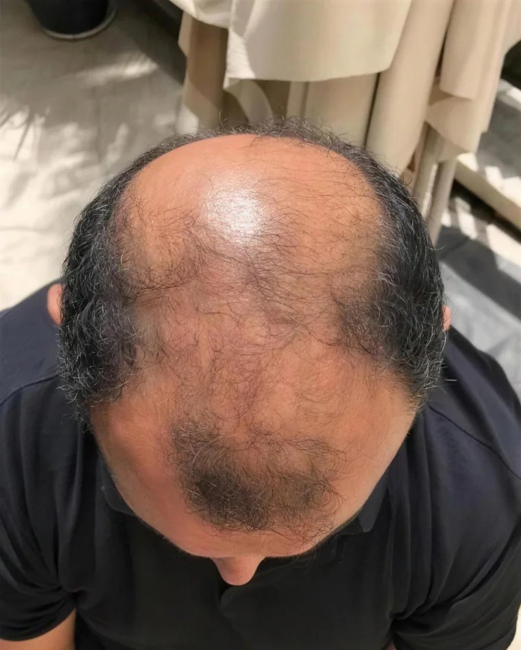 Omar S., before