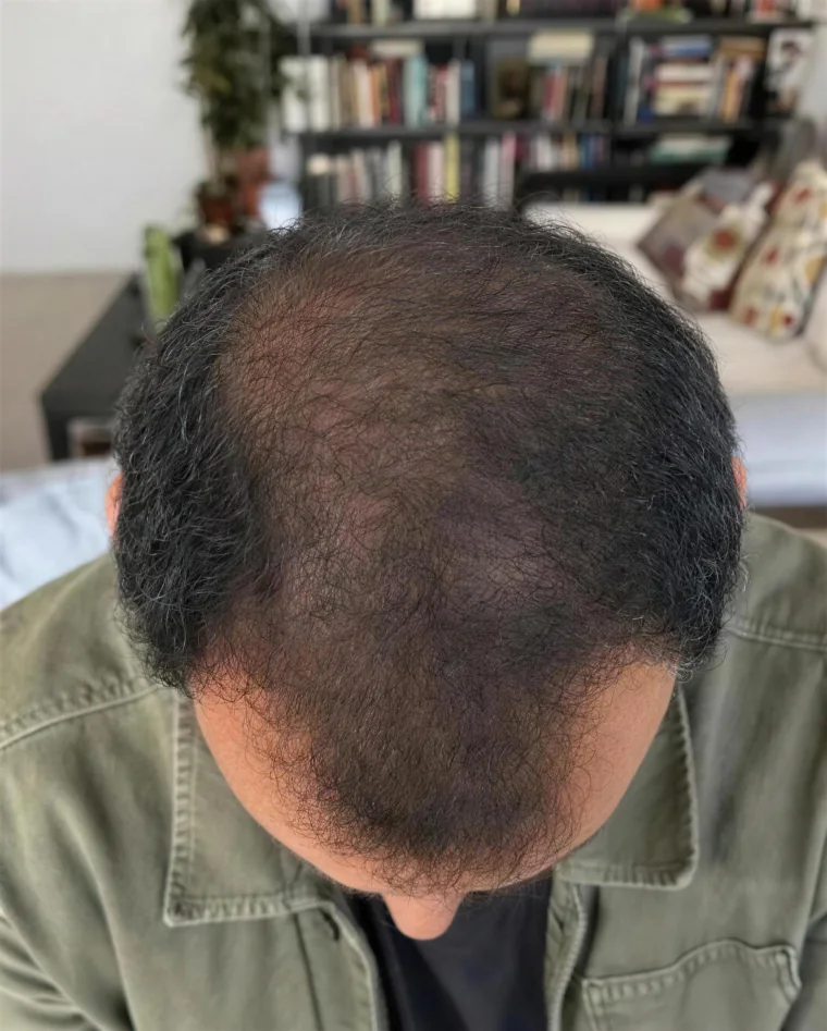 Omar S., month 9